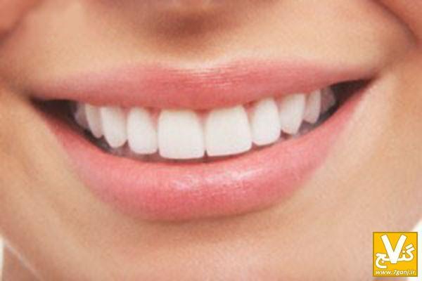 3 روش معجزه آسا برای سفید کردن دندان ها